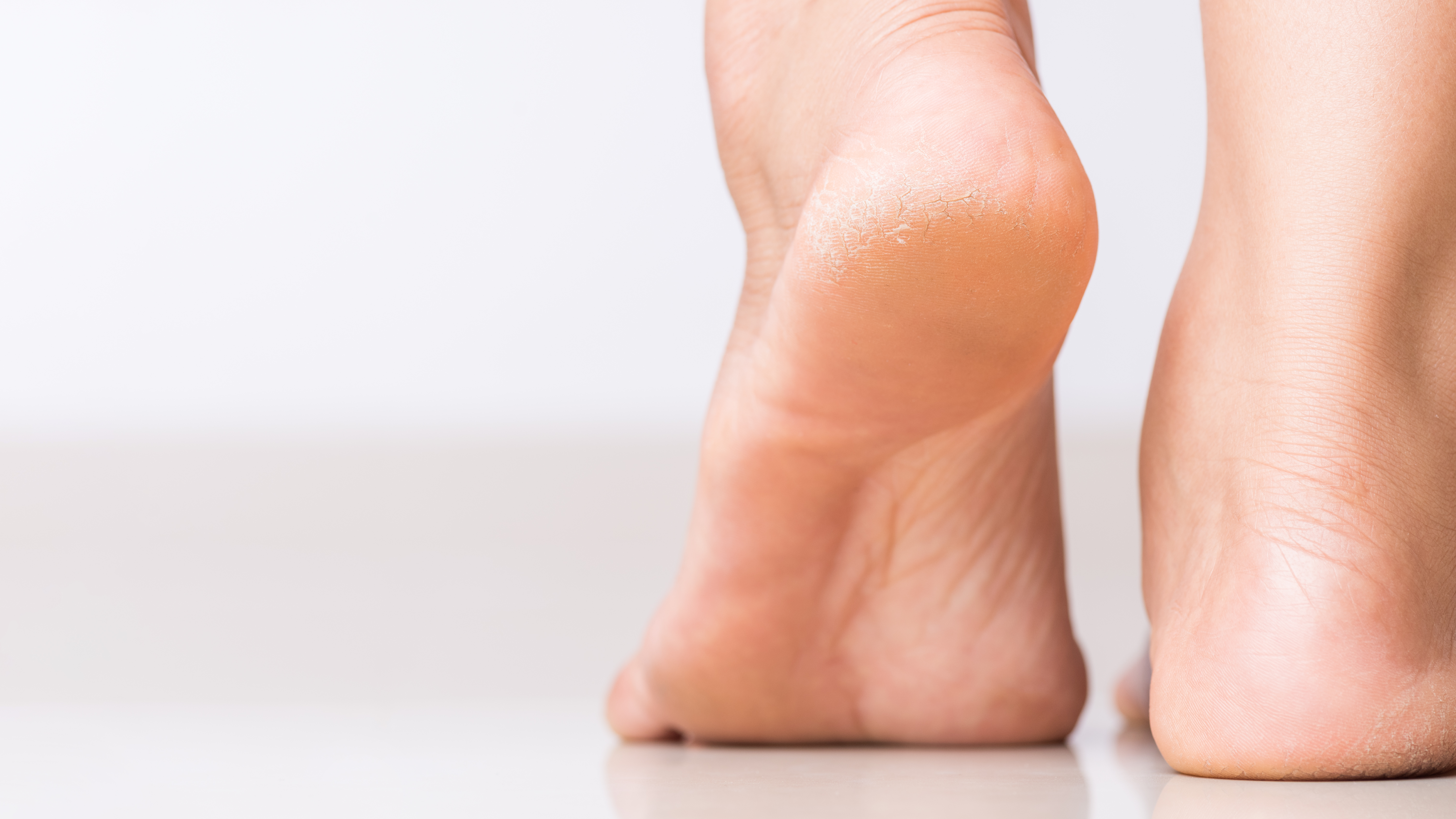 Trockene Füße als Header für Fußpflege im neubourg-professional Shop.